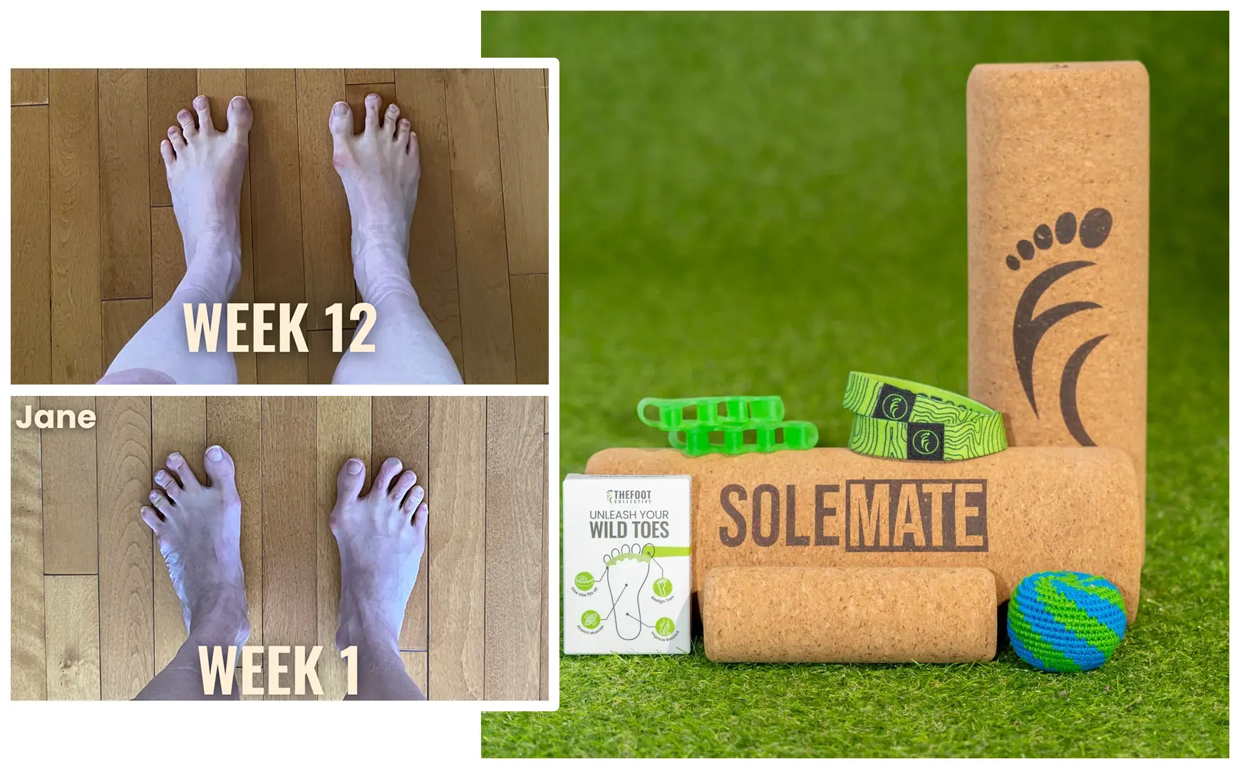 Image of the SoleMate Kit components