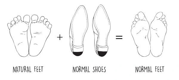 Natural feet are have a wide toe splay. Today's modern shoes have a very narrow toe box. When you put natural feet in modern shoes it deforms our feet by reducing our toe splay and cuases our toes to squish together.